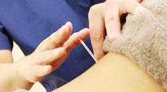 肩こりの施術例 南区 澄川