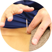 鍼灸 南区 澄川